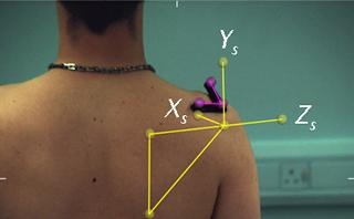 The bony landmarks of the shoulder blade (yellow) and the reflective markers used to track its movements (purple).